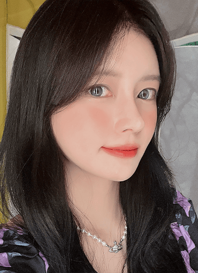 面部轮廓手术术后第一个月侧面