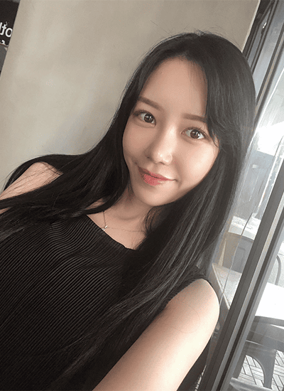 眼部整形+鼻部整形手术一个月后正面