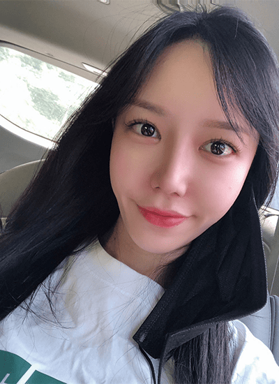 眼部整形+鼻部整形手术二个月后正面