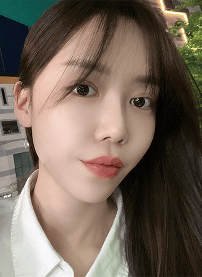 眼部整形+鼻部整形手术九个月后