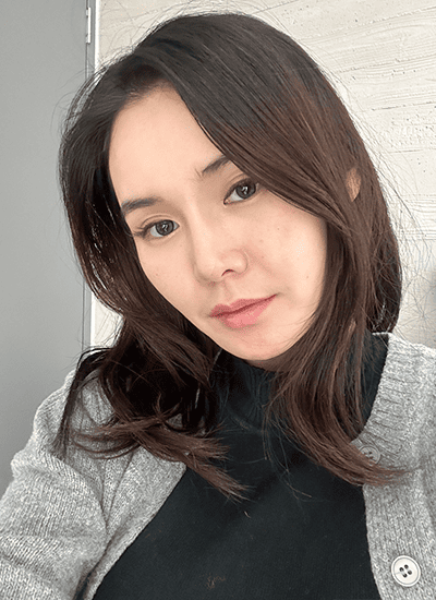 脂肪填充+埋线提升手术前