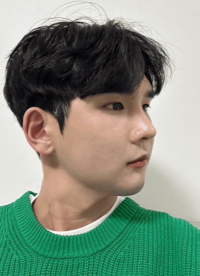 男士轮廓整形手术二周后侧面