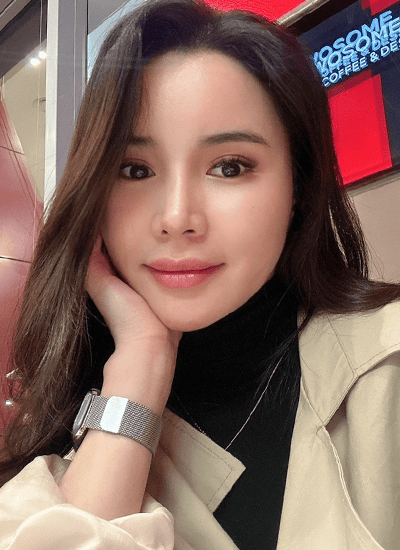 脂肪填充+埋线提升手术二周后正面