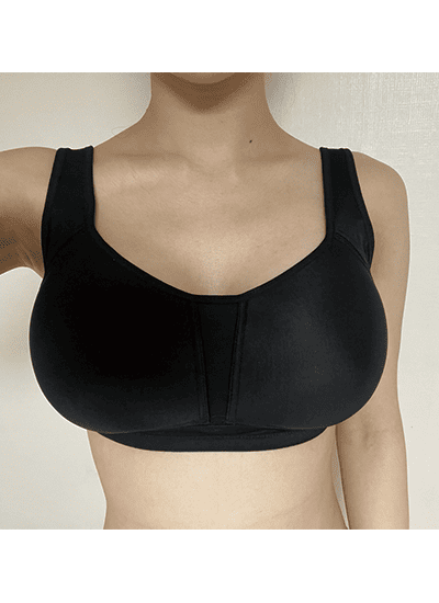 隆胸手术三周后正面