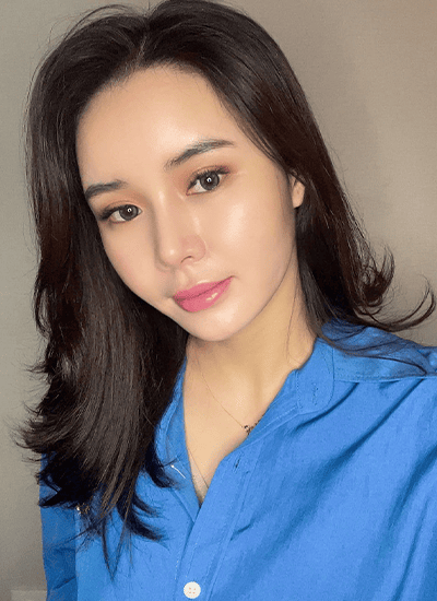 脂肪填充+埋线提升手术三周后正面