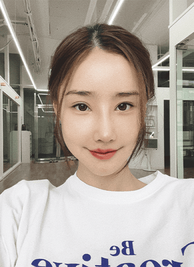 隆鼻手术七天后正面