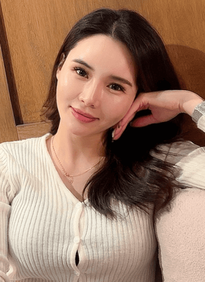 脂肪填充+埋线提升手术一个月后