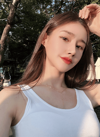 隆鼻手术一个月后正面