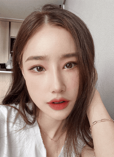 隆鼻手术二个月后正面