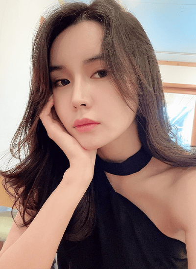 脂肪填充+埋线提升手术二个月后正面