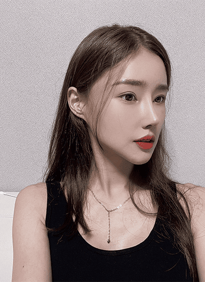 隆鼻手术三个月后侧面