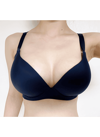 隆胸手术四个月后