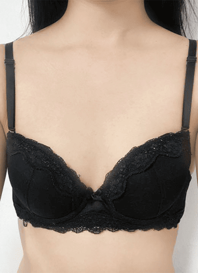 隆胸手术手术前正面