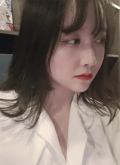 面部轮廓+鼻部整形+眼部整形术后四个月侧面