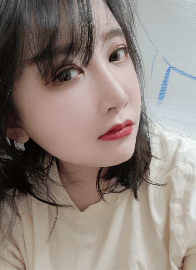 面部轮廓+鼻部整形+眼部整形术后五个月侧面