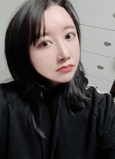 面部轮廓+鼻部整形+眼部整形术后六个月