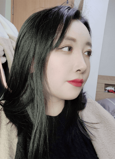 面部轮廓+鼻部整形+眼部整形术后七个月侧面