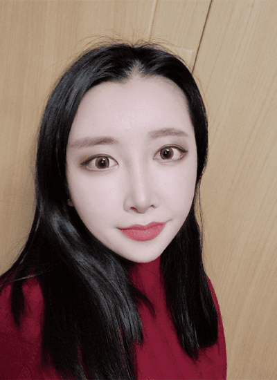 面部轮廓+鼻部整形+眼部整形术后八个月正面