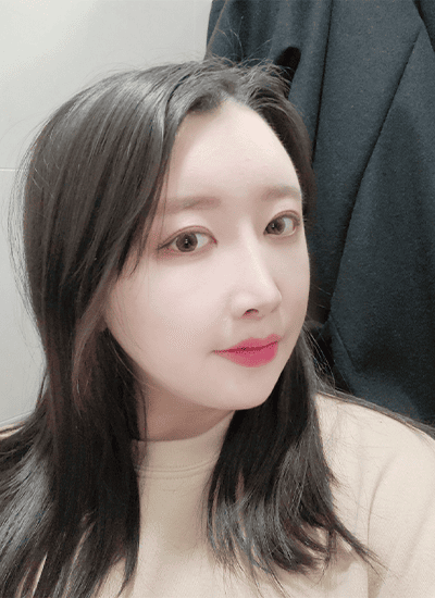 面部轮廓+鼻部整形+眼部整形术后九个月侧面