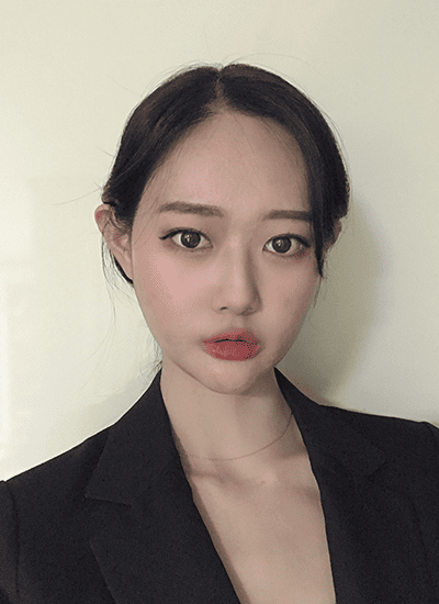 面部轮廓手术十二个月后正面