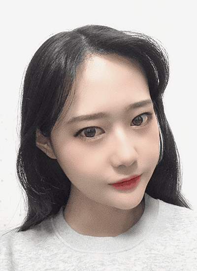 面部轮廓手术七个月后