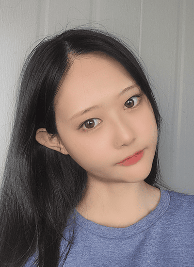 面部轮廓手术五个月后