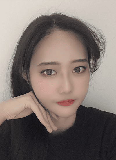 面部轮廓手术八个月后