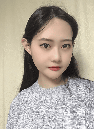 面部轮廓手术九个月后