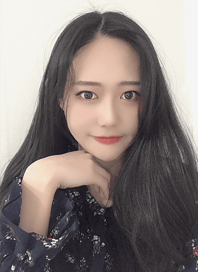 面部轮廓手术十个月后正面