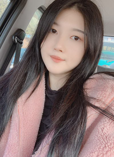 隆鼻手术+轮廓三件套手术五个月后