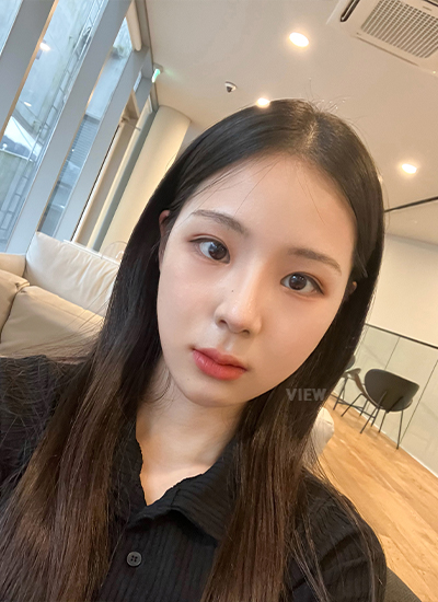 轮廓三件套、鼻部手术手术一个月后 & 眼部修复手术一周后正面