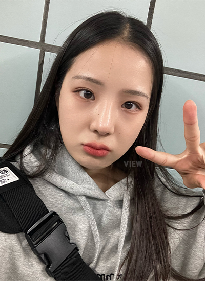 轮廓三件套、眼部修复手术、鼻部手术手术三个月后