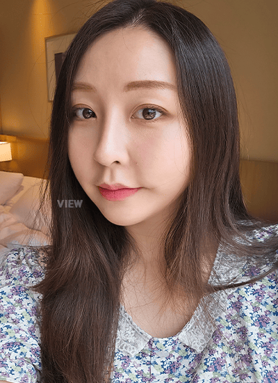 眼部整形、鼻部整形、轮廓整形手术一个月后