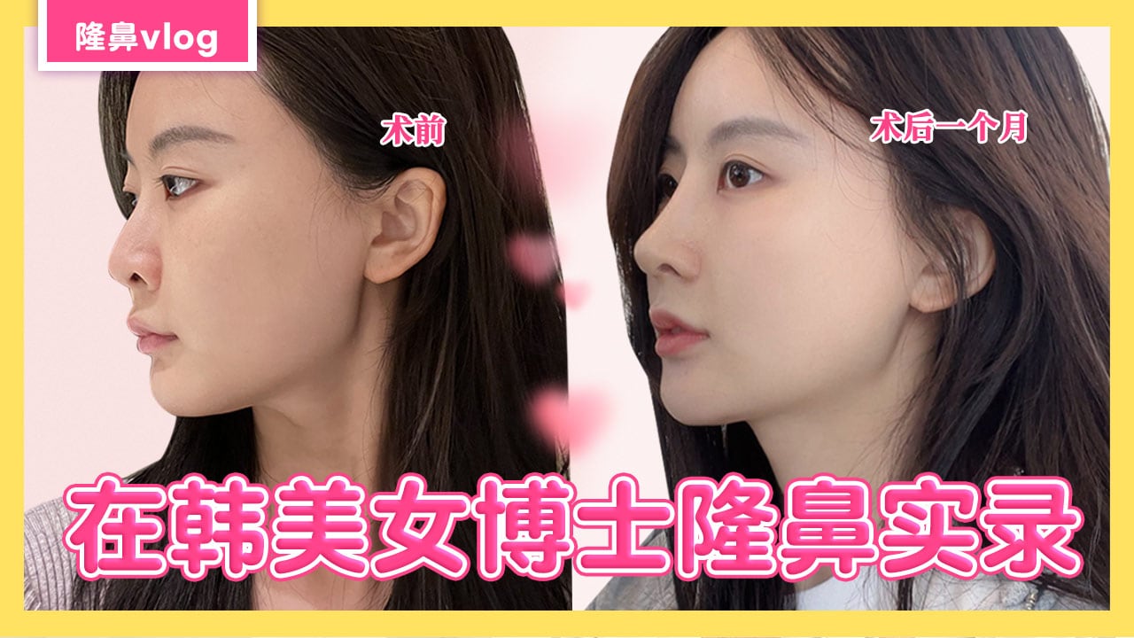 코