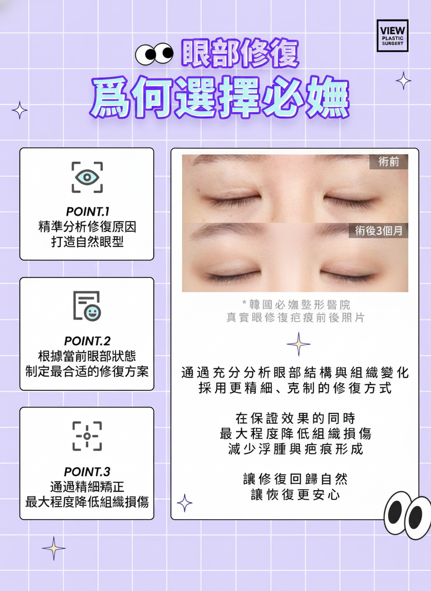 必妩双眼皮
