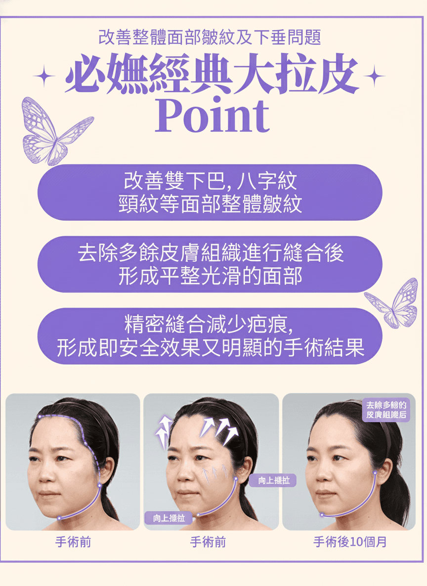 必妩拉皮