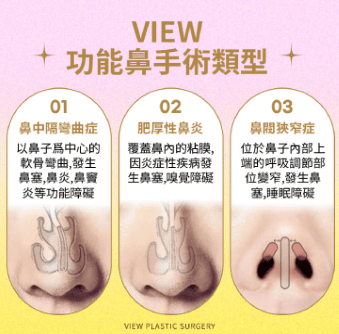功能鼻整形
