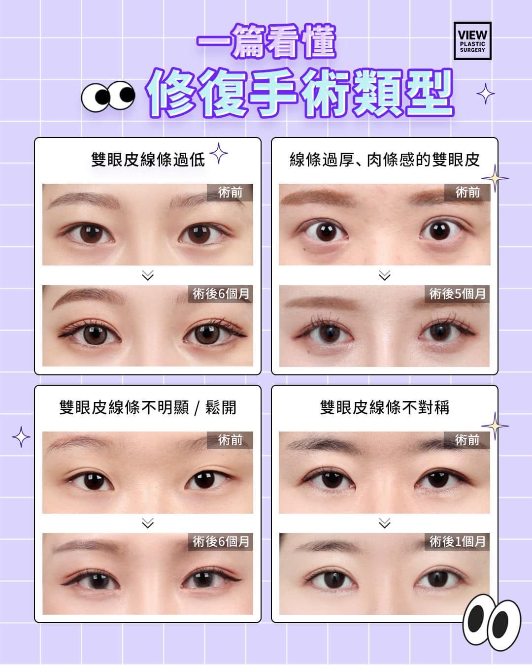 韩国眼睛修复