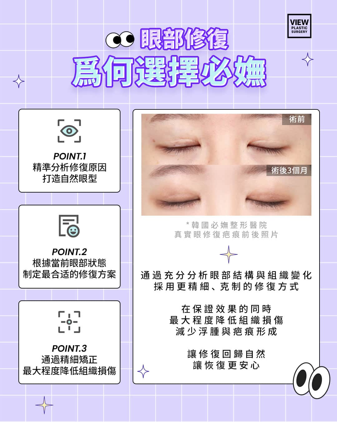 韩国眼睛修复