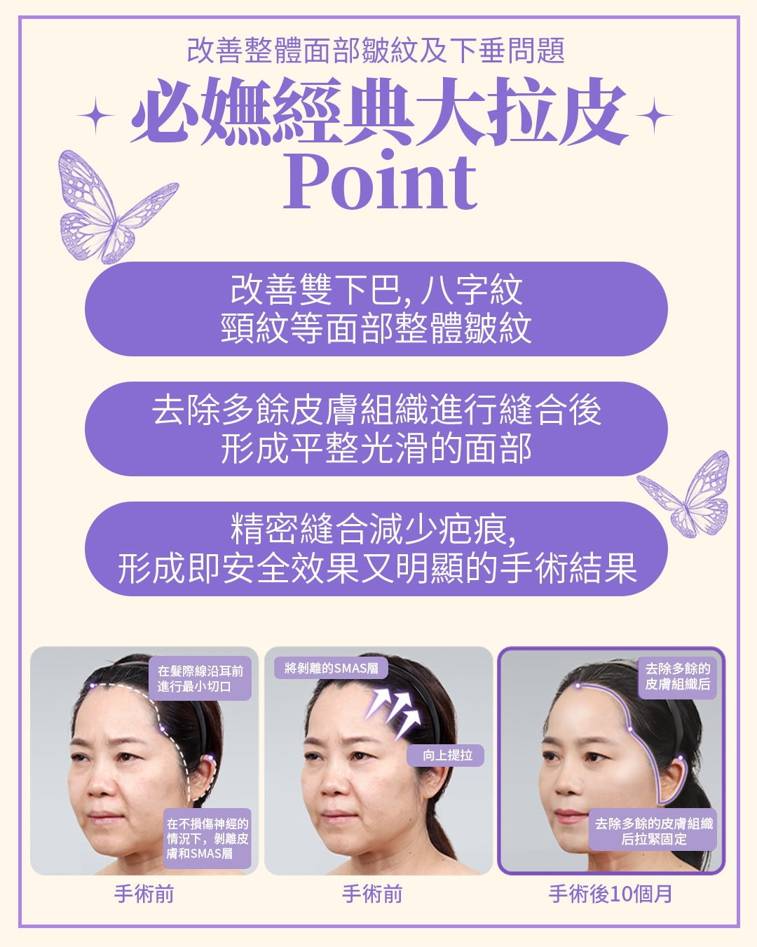 韩国抗衰老
