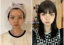 View韩国面部轮廓手术，追求“妈生脸”的速看！