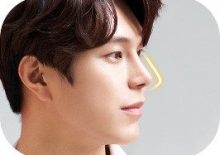 一文了解View韩国鼻子修复手术男性美学思路！
